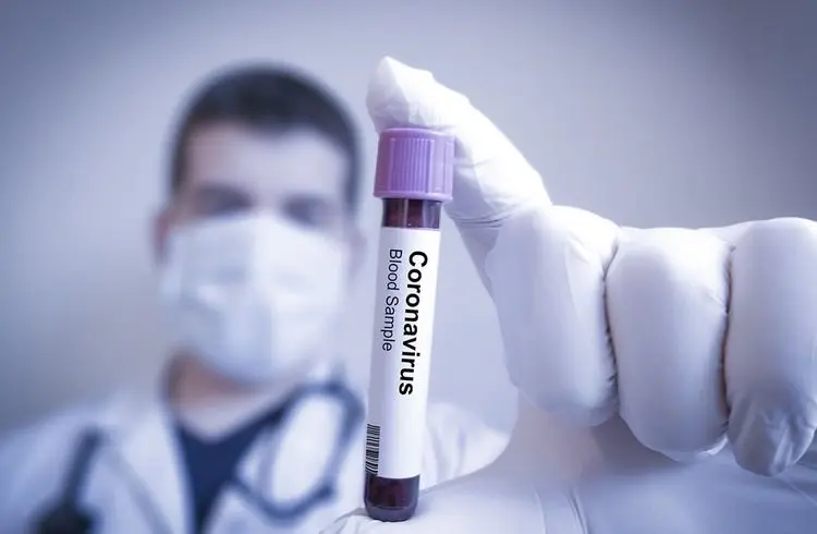 Impfstoffhersteller müssen Umsatzeinbußen hinnehmen, da die Nachfrage nach Covid-Impfstoffen sinkt
